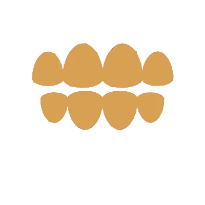 Имплантация зубов